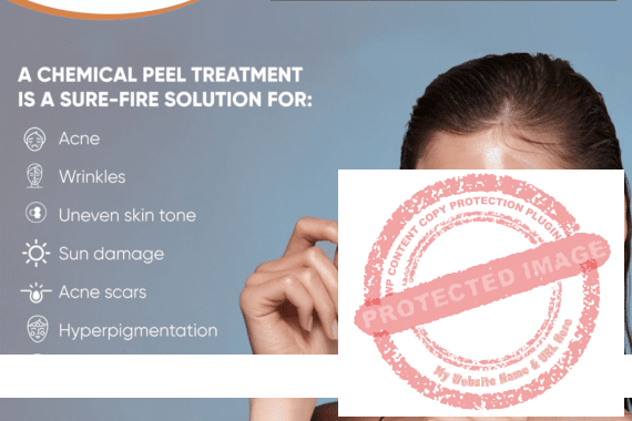 Chemical Peel Treatment in Anna Nagar