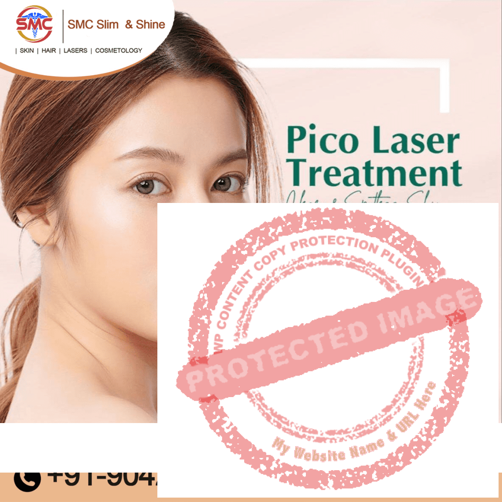 Pico Laser Treatment in Anna Nagar